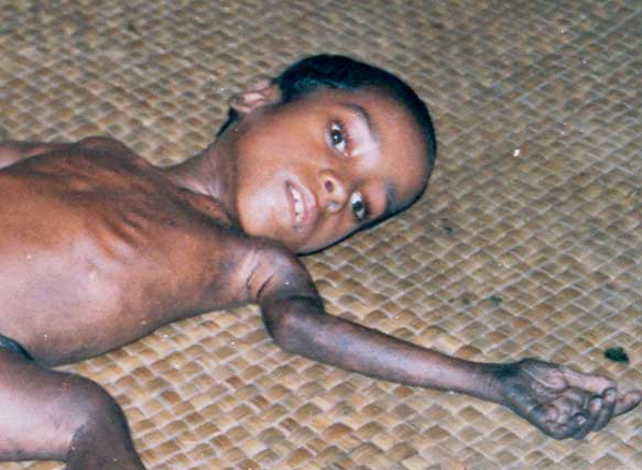 Endosulfan victim